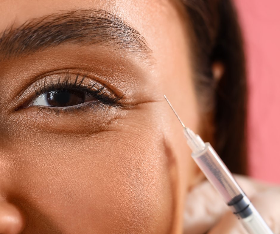 Undereye Filler